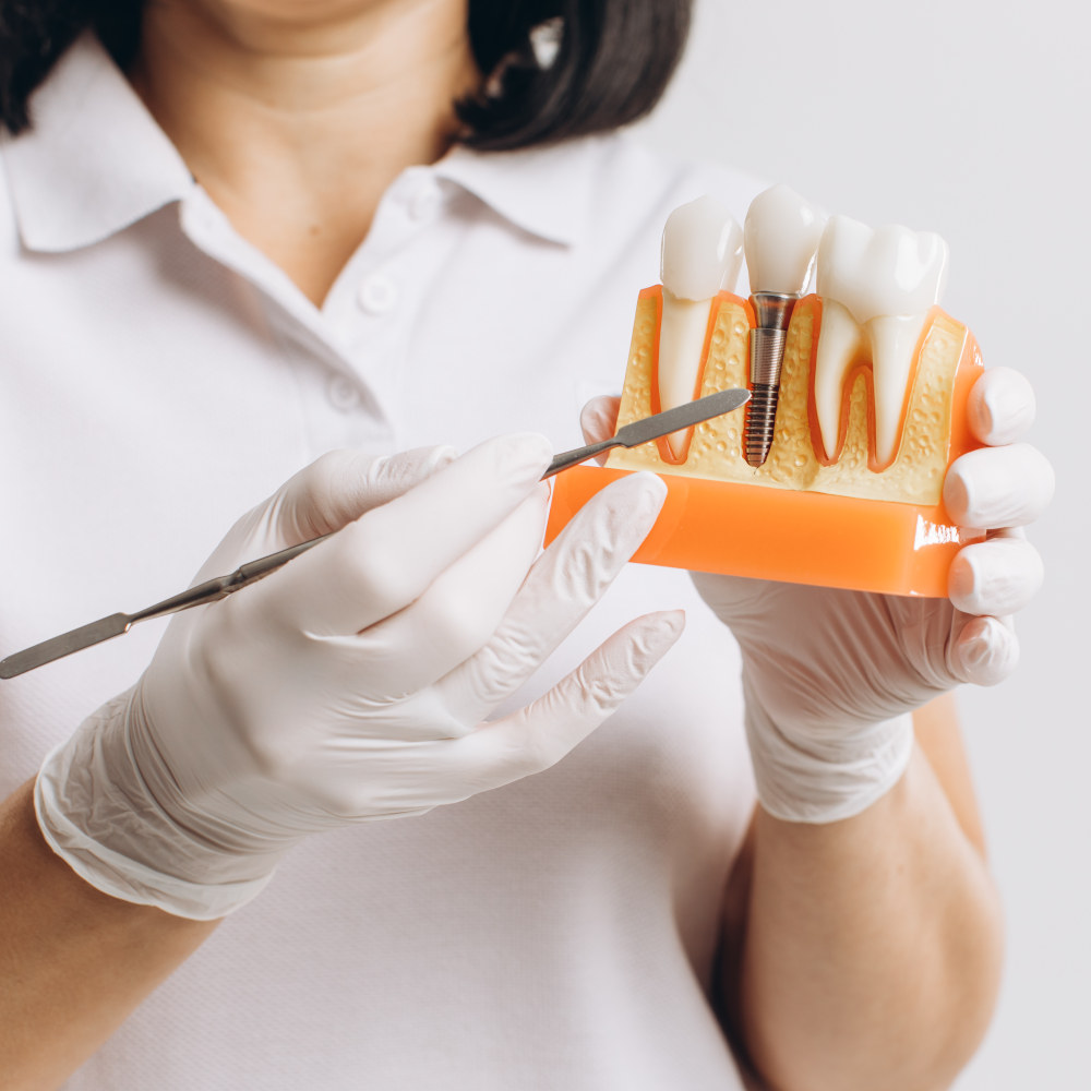 IMPLANT
