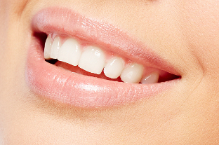 Blanchiment des dents à Poitiers 86000